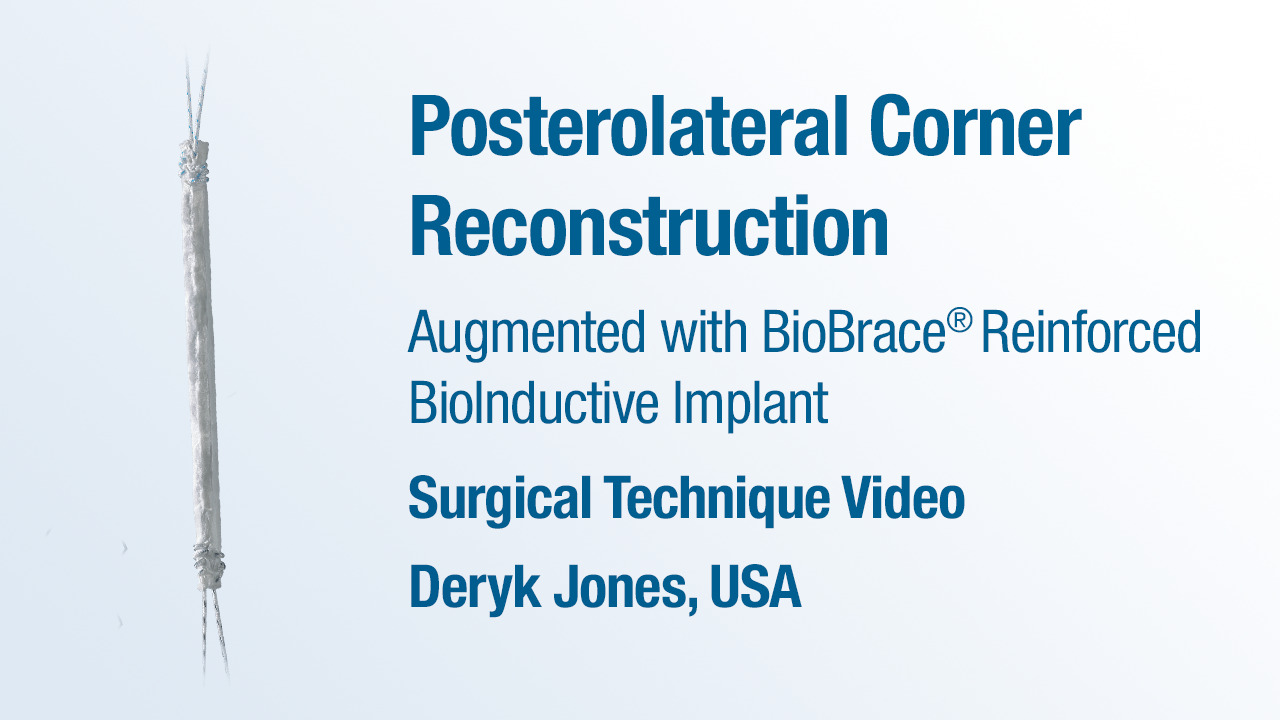 Dr. Jones - Posterolateral Corner Reconstruction Augmented with BioBrace® BioInductive Implant