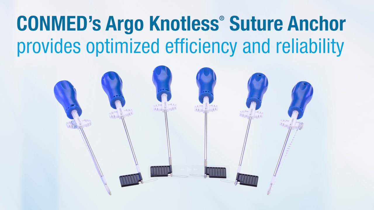 Argo Knotless® Suture Anchor - Product Video