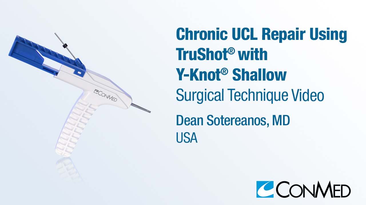 Dr. Sotereanos - Chronic UCL Repair Using TruShot® with Y-Knot® Shallow