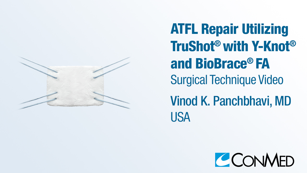 Dr. Panchbhavi - ATFL Repair Utilizing TruShot® FA with Y-Knot® and BioBrace® FA