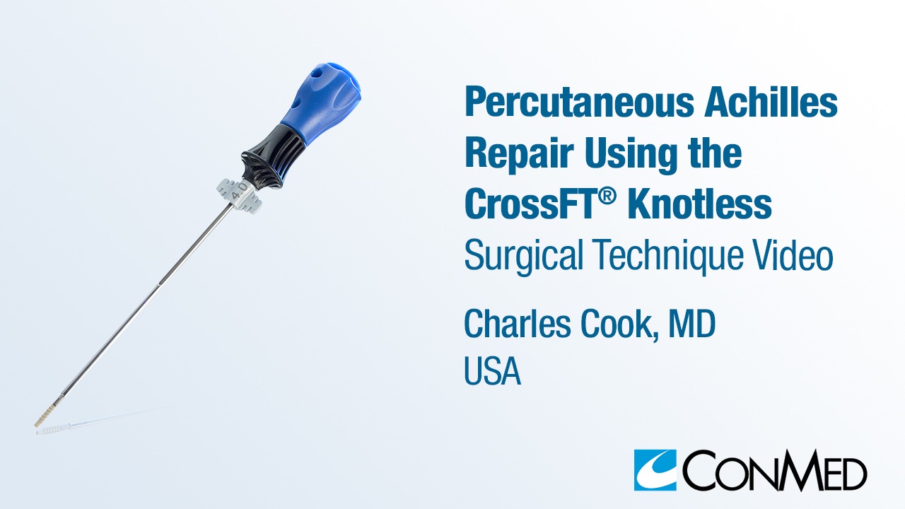 Dr. Cook - Percutaneous Achilles Repair Using the CrossFT® Knotless