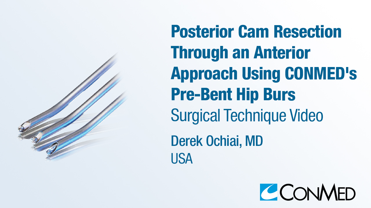 Dr. Ochiai - Posterior Cam Resection Through an Anterior Approach Using CONMED's Pre-Bent Hip Burs