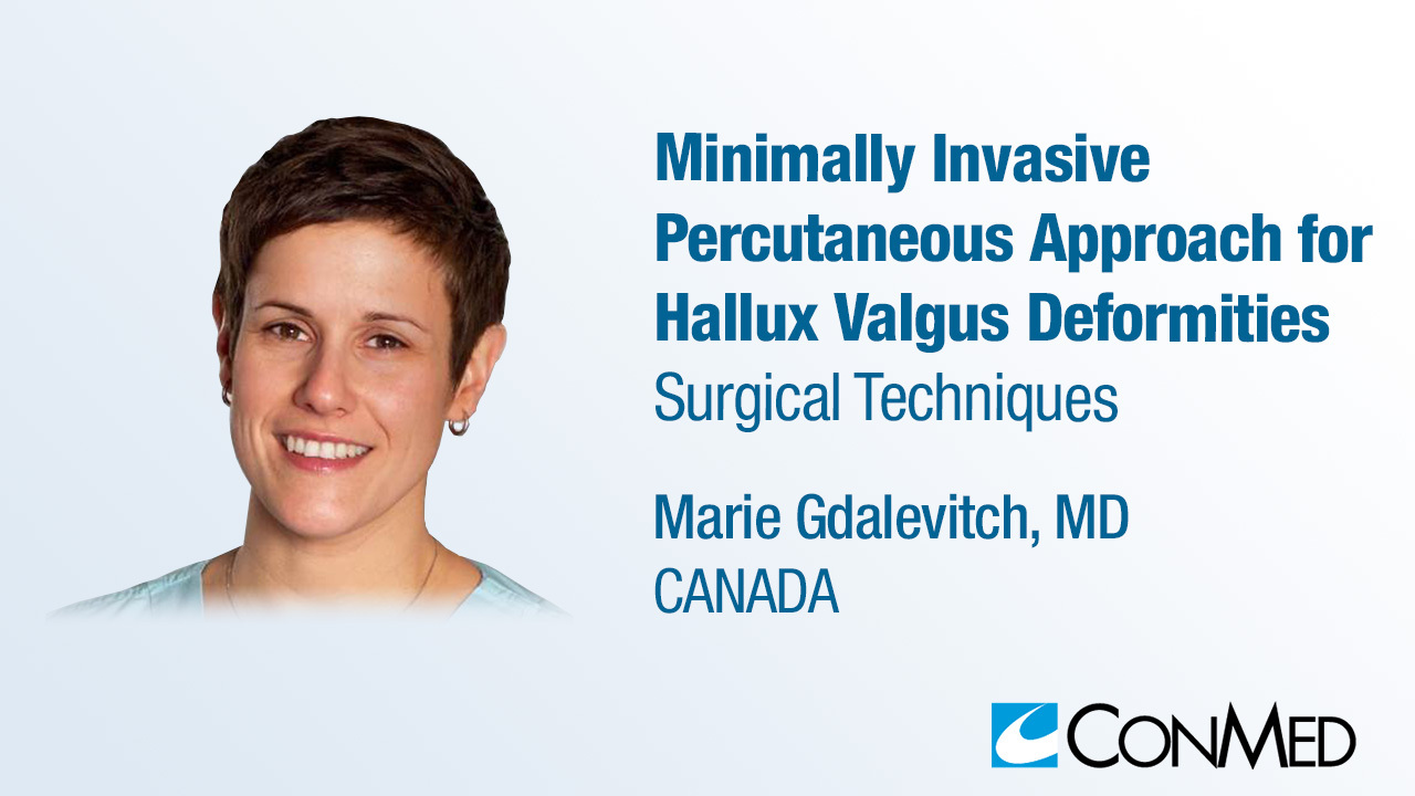 Dr. Gdalevitch - Minimally Invasive Percutaneous Approach for Hallux Valgus Deformities