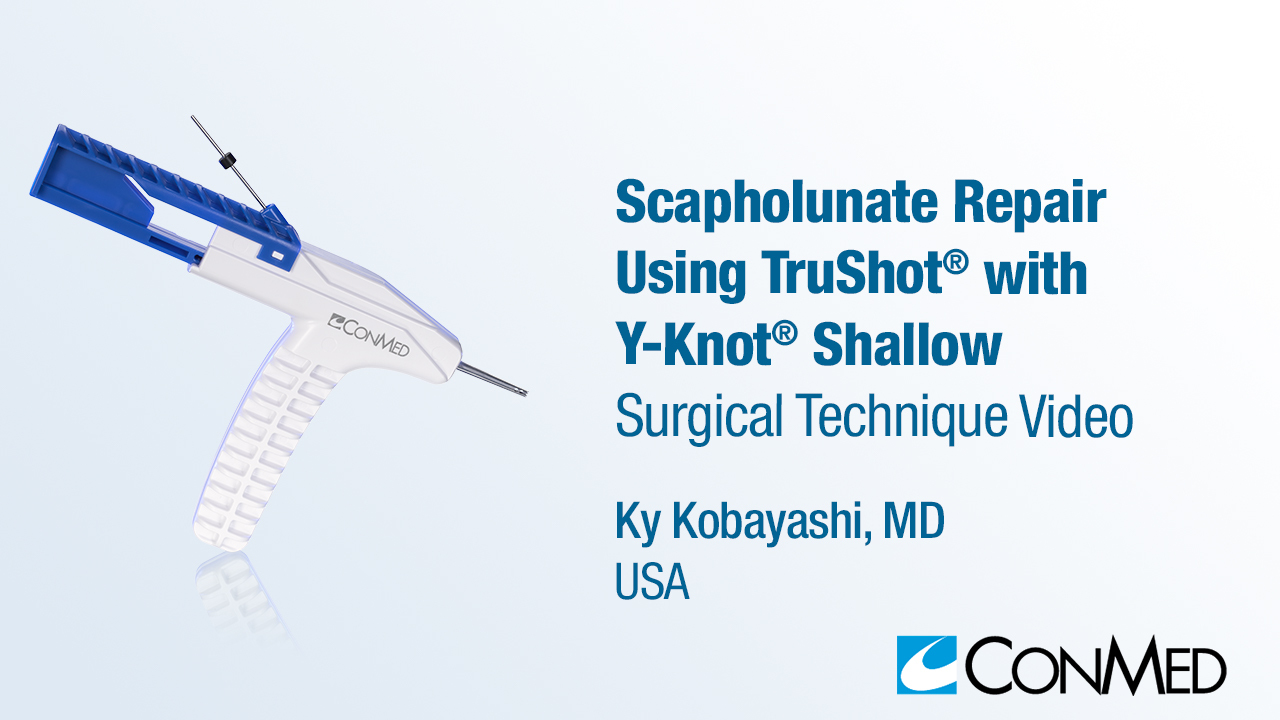 Dr. Kobayashi - Scapholunate Repair Using TruShot® with Y-Knot® Shallow