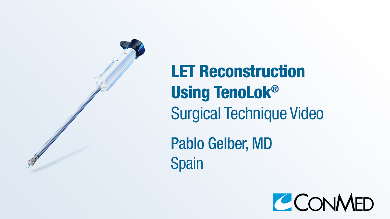 Dr. Gelber - LET Reconstruction Using TenoLok®