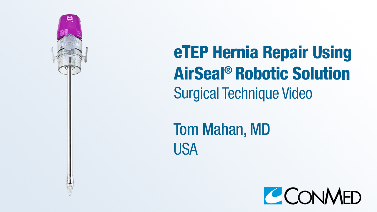 Dr. Mahan - eTEP Hernia Repair Using AirSeal® Robotic Solution