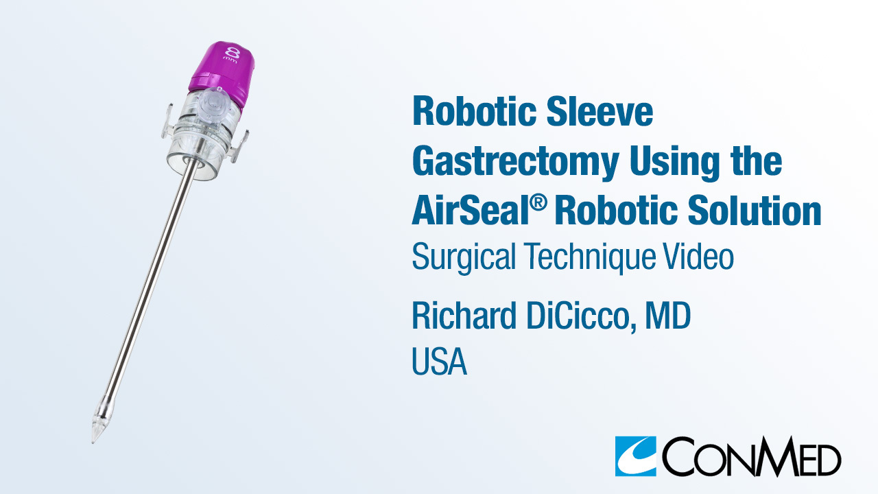 Dr. DiCicco - Robotic Sleeve Gastrectomy Using the AirSeal® Robotic Solution