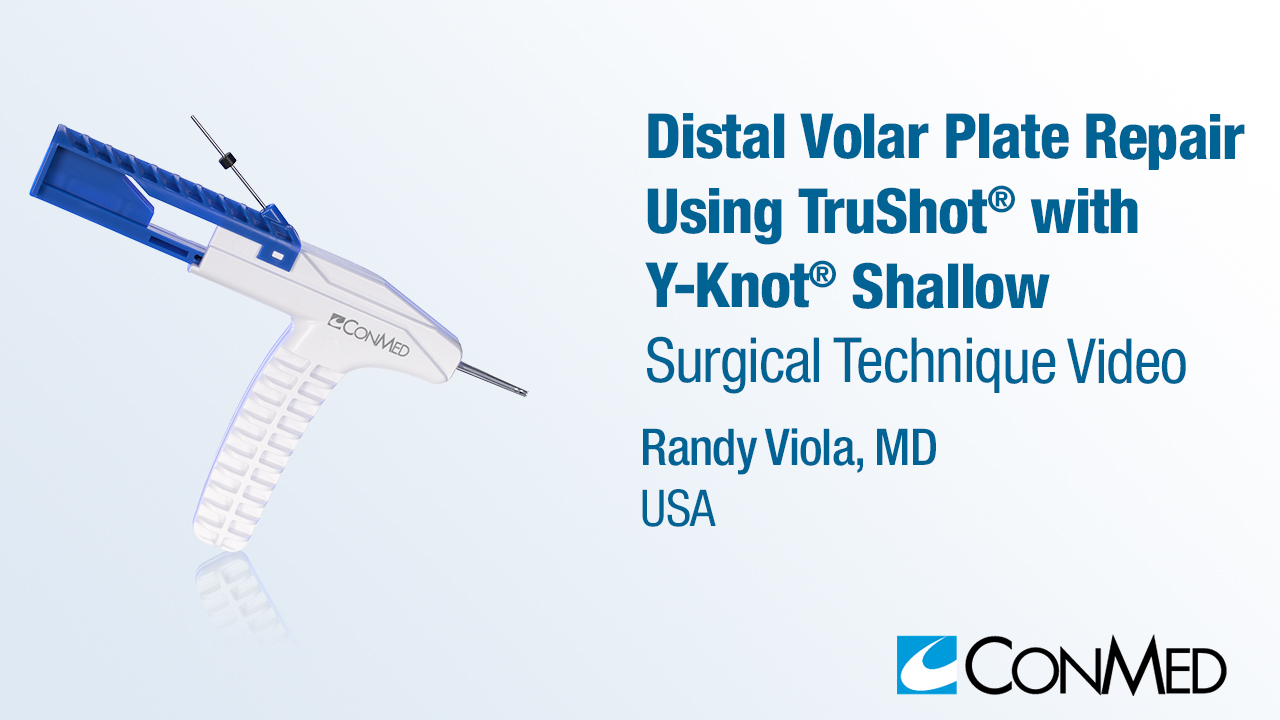 Dr. Viola - Distal Volar Plate Repair Using TruShot® with Y-Knot® Shallow