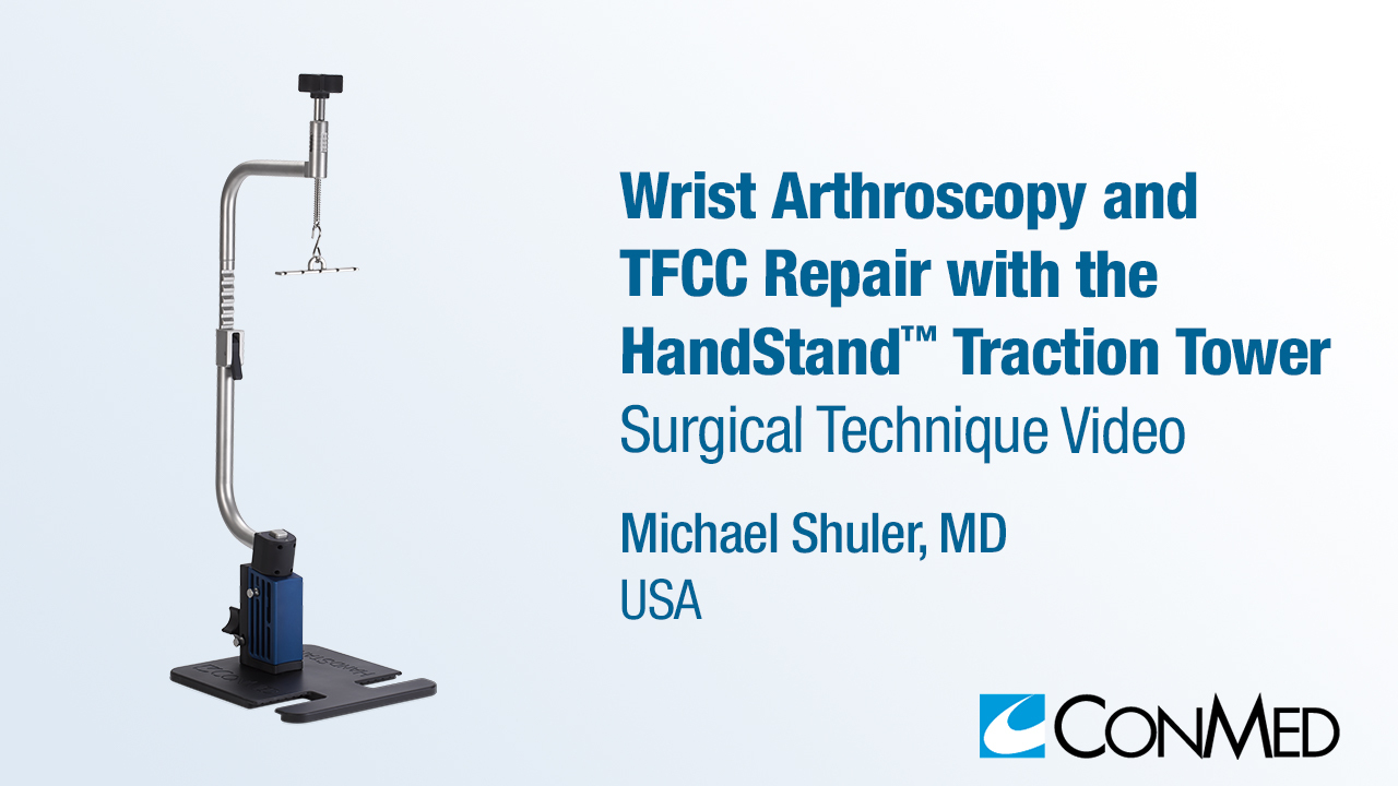 Dr. Shuler - Wrist Arthroscopy and TFCC Repair with the HandStand™ Traction Tower