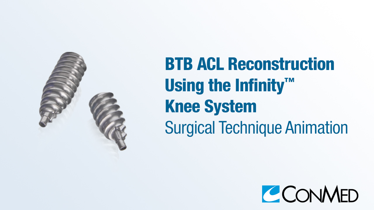 BTB ACL Reconstruction Using the Infinity™ Knee System