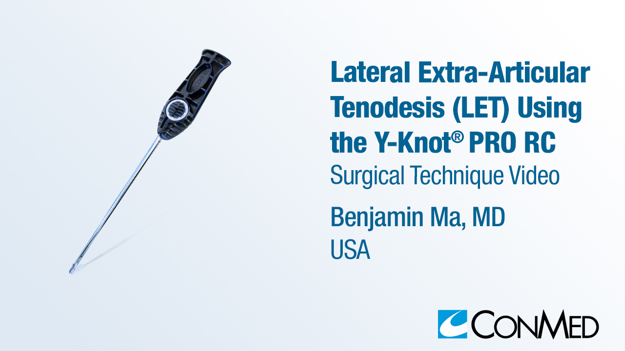 Dr. Ma - Lateral Extra-Articular Tenodesis (LET) Using Y-Knot® PRO RC