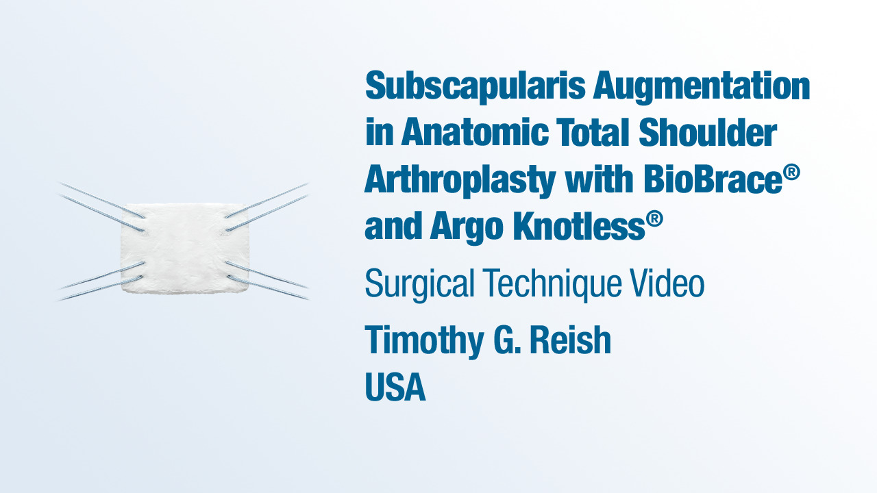 Dr. Reish - Subscapularis Augmentation in Anatomic TSA with BioBrace® and Argo Knotless®