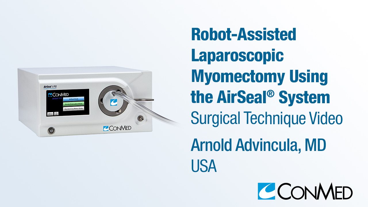 Dr. Advincula - Robot-Assisted Laparoscopic Myomectomy Using the AirSeal® System