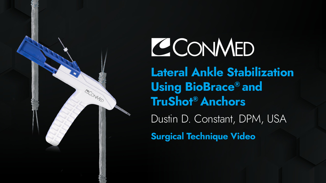 Dr. Constant - Lateral Ankle Stabilization Using BioBrace® and TruShot®