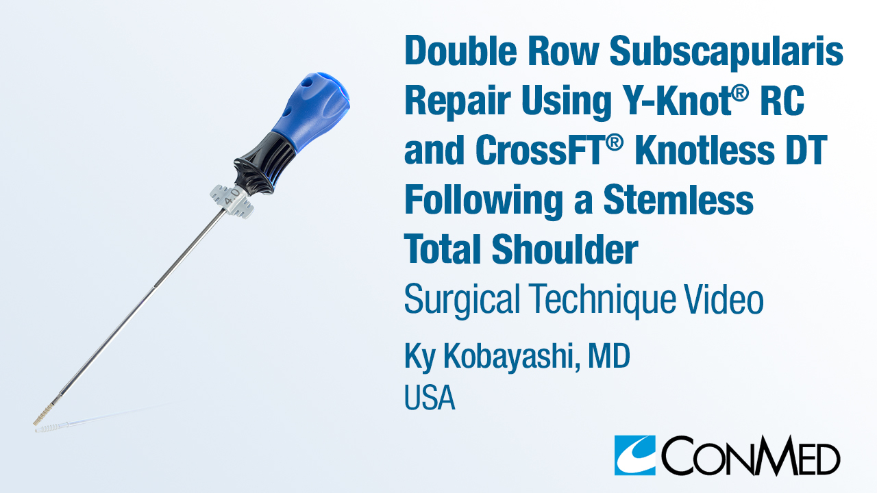 Dr. Kobayashi - Double Row Subscapularis Repair Using Y-Knot® RC and CrossFT® Knotless DT Following a Stemless Total Shoulder
