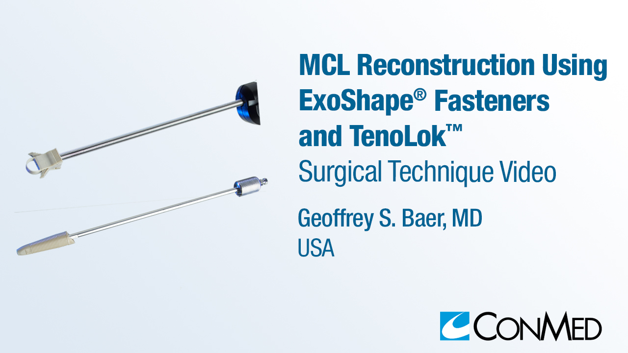 Dr. Baer - MCL Reconstruction Using ExoShape® Femoral Fastener and TenoLok®