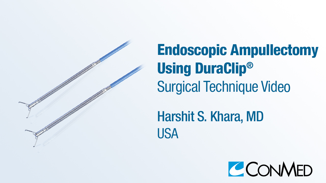 Dr. Khara - Endoscopic Ampullectomy Using DuraClip®