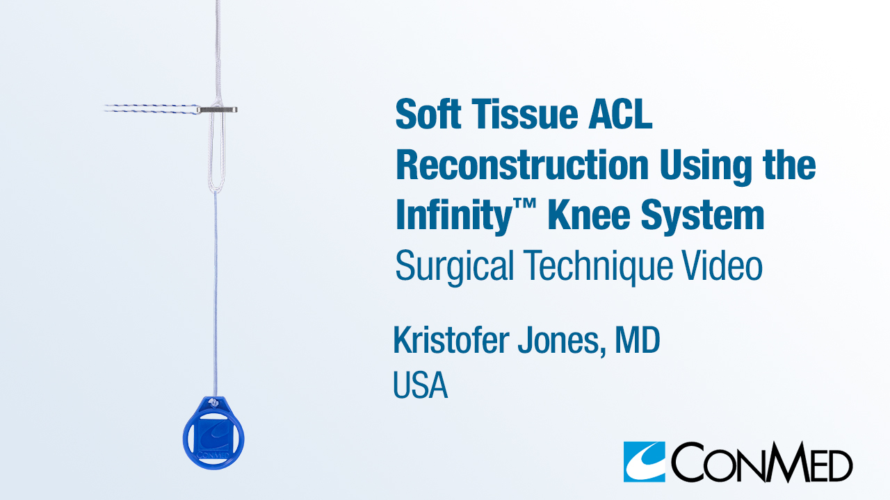 Dr. Jones - Soft Tissue ACL Reconstruction Using the Infinity™ Knee System