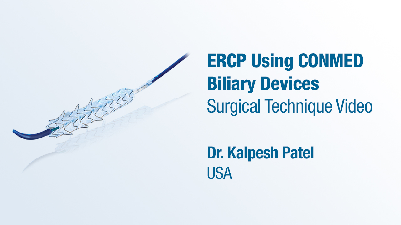 Dr. Patel - ERCP Using the CONMED Biliary Devices