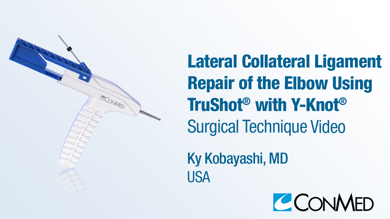 Dr. Kobayashi - Lateral Collateral Ligament Repair of the Elbow Using  TruShot® with Y-Knot® - Collateral Ligament - CONMED VIDEO GALLERY