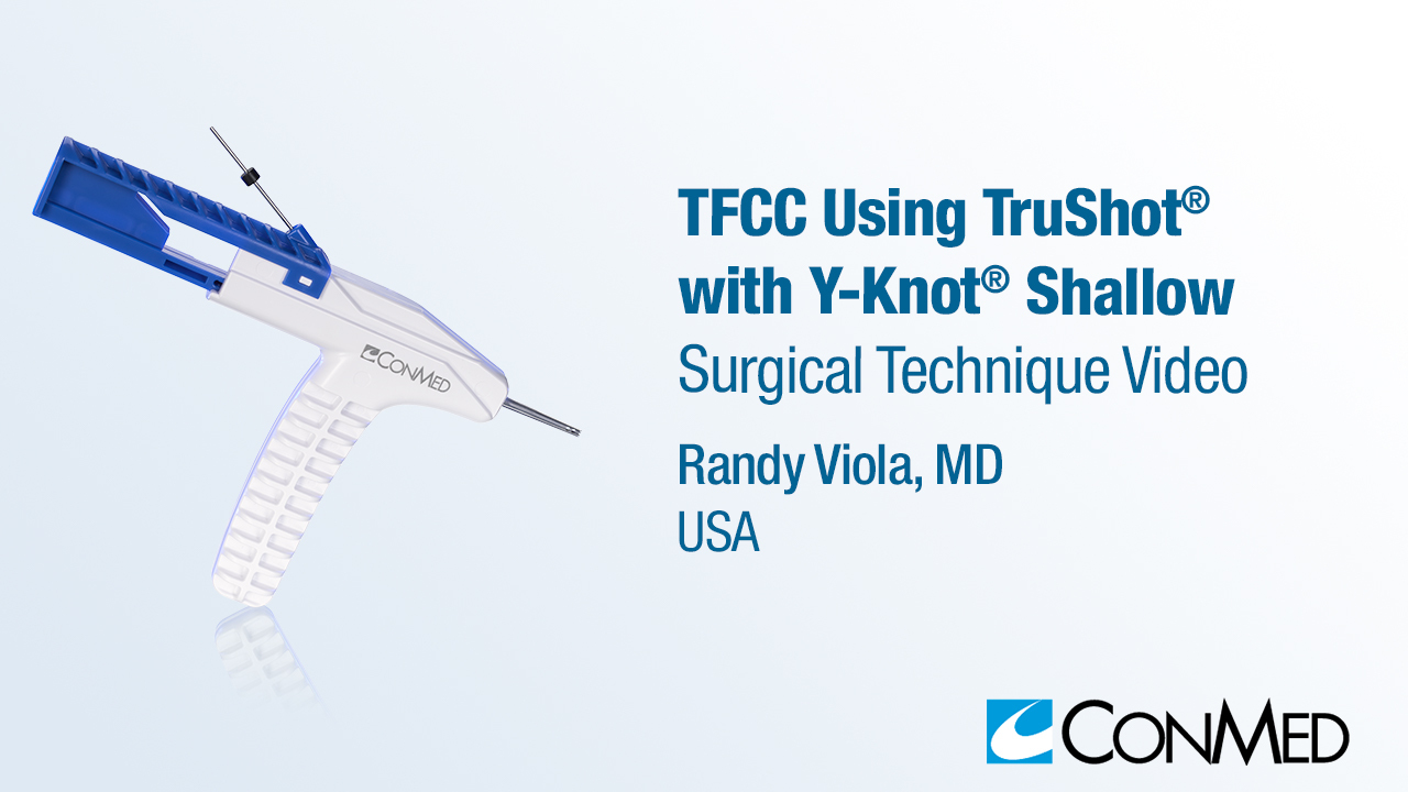 Dr. Viola - TFCC Using TruShot® with Y-Knot® Shallow