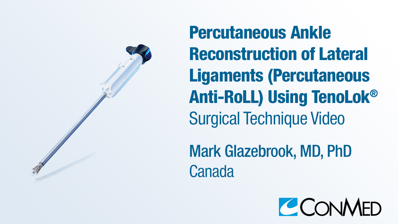 Dr. Glazebrook - Percutaneous Ankle Reconstruction of Lateral Ligaments (Percutaneous Anti-RoLL) Using TenoLok®