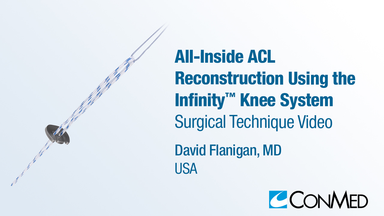 Dr. Flanigan - All-Inside ACL Reconstruction Using the Infinity™ Knee System