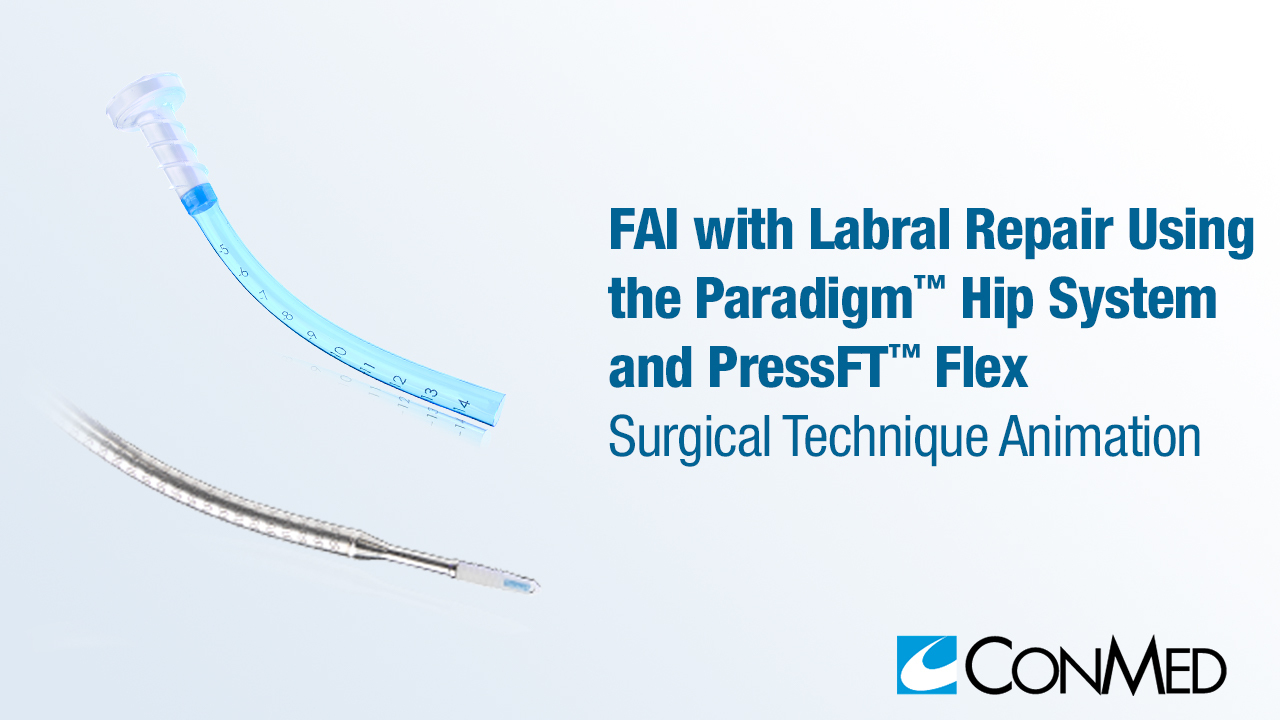 FAI with Labral Repair Using the Paradigm® Hip System and PressFT™ Flex