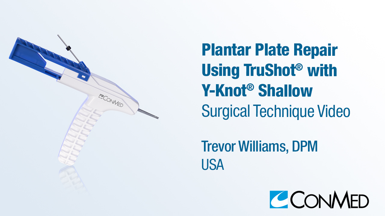 Dr. Williams - Plantar Plate Repair Using TruShot® with Y-Knot® Shallow