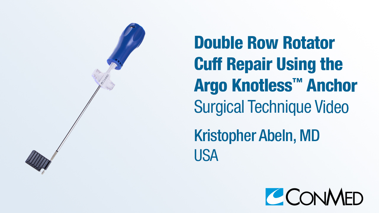 Dr. Abeln - Double Row Rotator Cuff Repair Using the Argo Knotless® Anchor