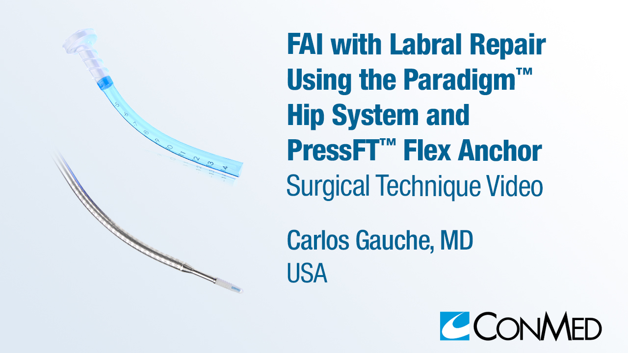 Dr. Guanche - FAI with Labral Repair Using the Paradigm® Hip System and PressFT™ Flex Anchor