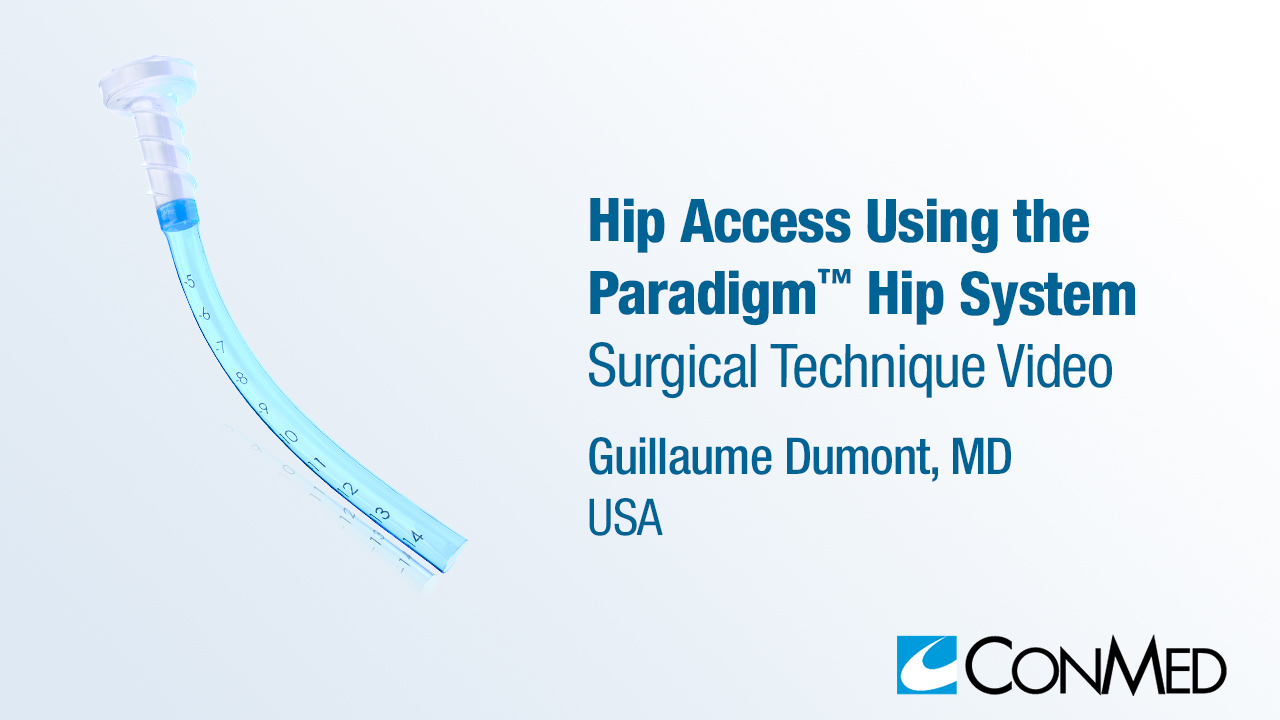 Dr. Dumont - Hip Access Using the Paradigm® System