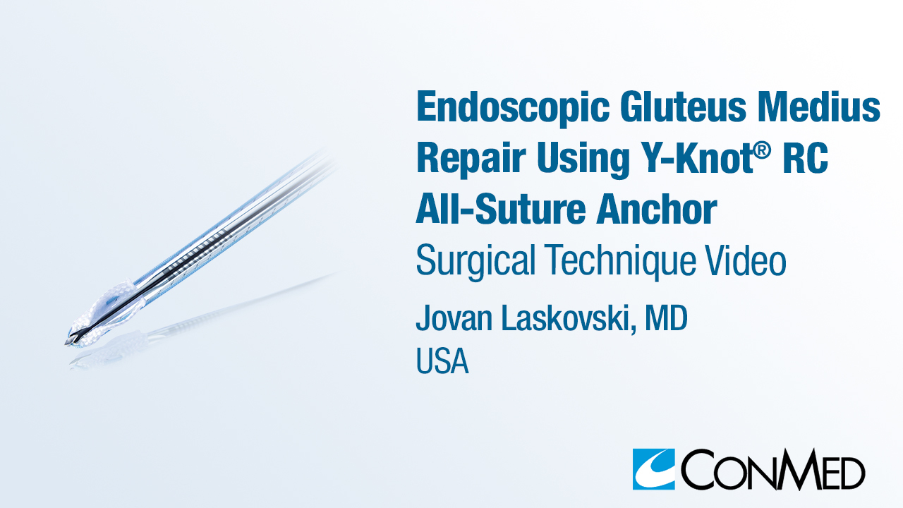 Dr. Laskovski - Endoscopic Gluteus Medius Repair Using Y-Knot® RC
