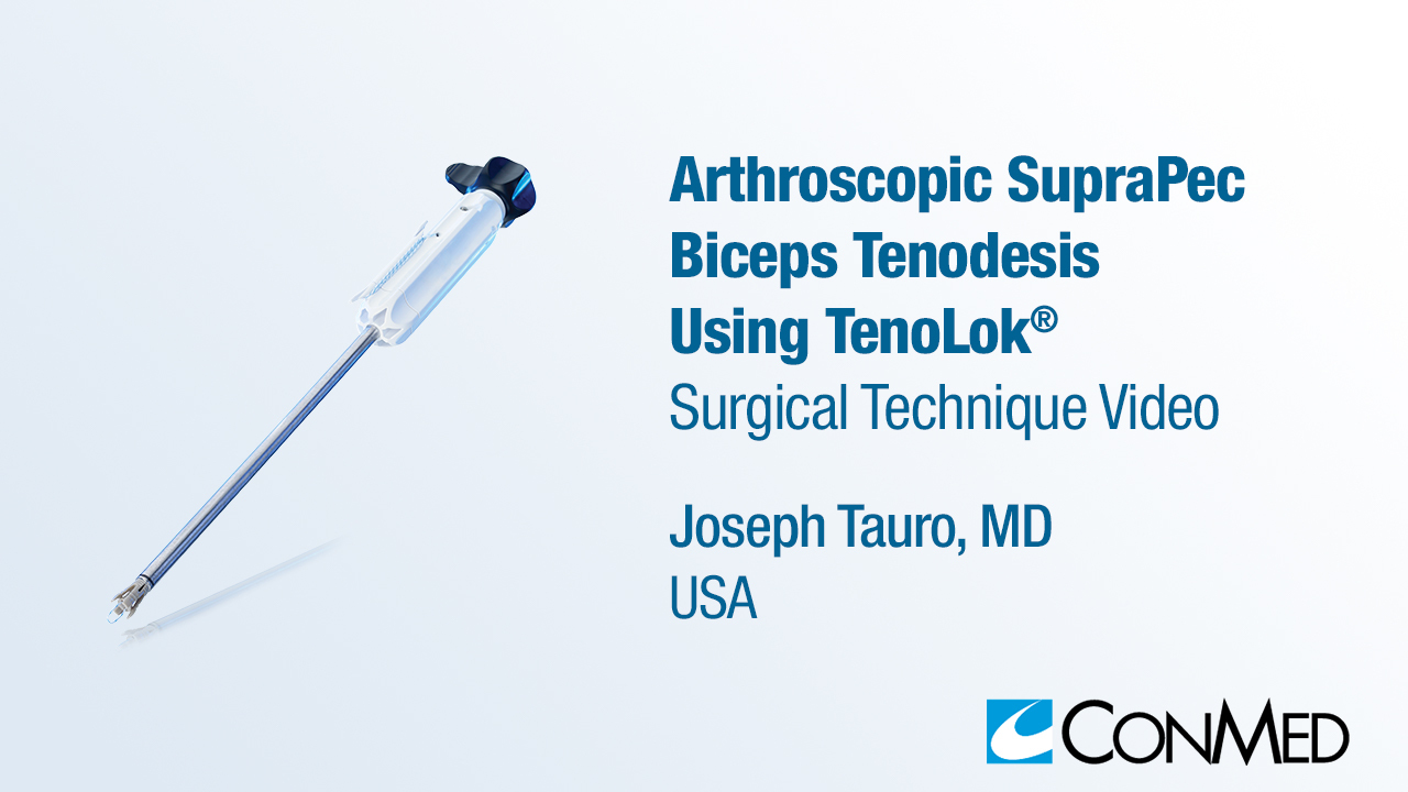 Dr. Tauro - Arthroscopic SupraPec Biceps Tenodesis Using TenoLok®