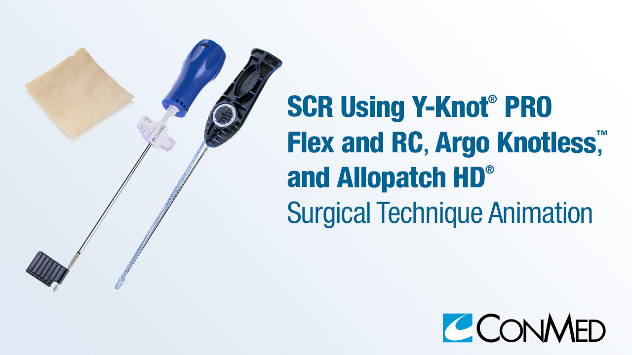 SCR Using Y-Knot® PRO Flex, Y-Knot® PRO RC, Argo Knotless®, and Allopatch HD®