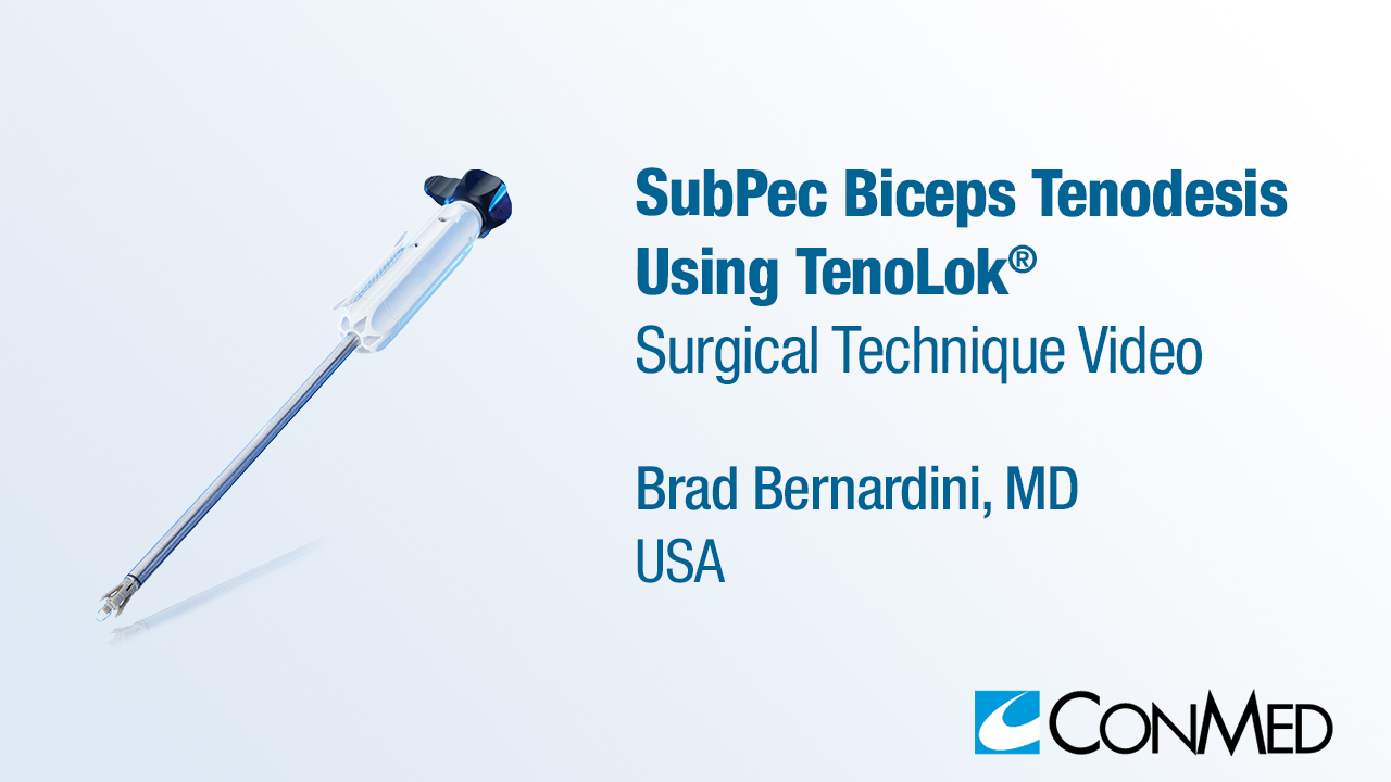 Dr. Bernardini - SubPec Biceps Tenodesis Using TenoLok®