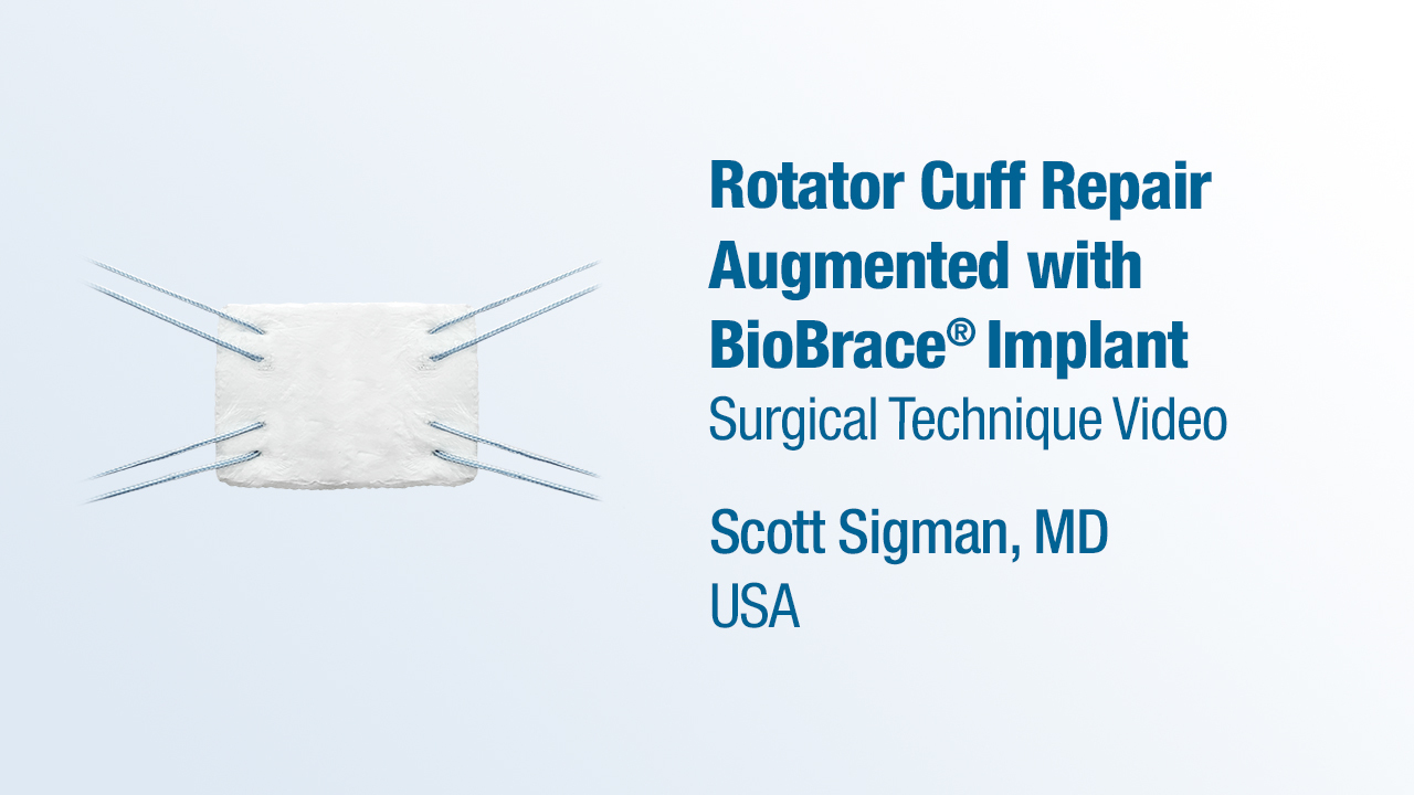 Dr. Sigman - Rotator Cuff Repair Augmented with BioBrace® Reinforced Implant