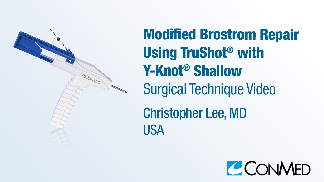 Dr. Lee - Brostrom Repair Using TruShot® with Y-Knot® Shallow