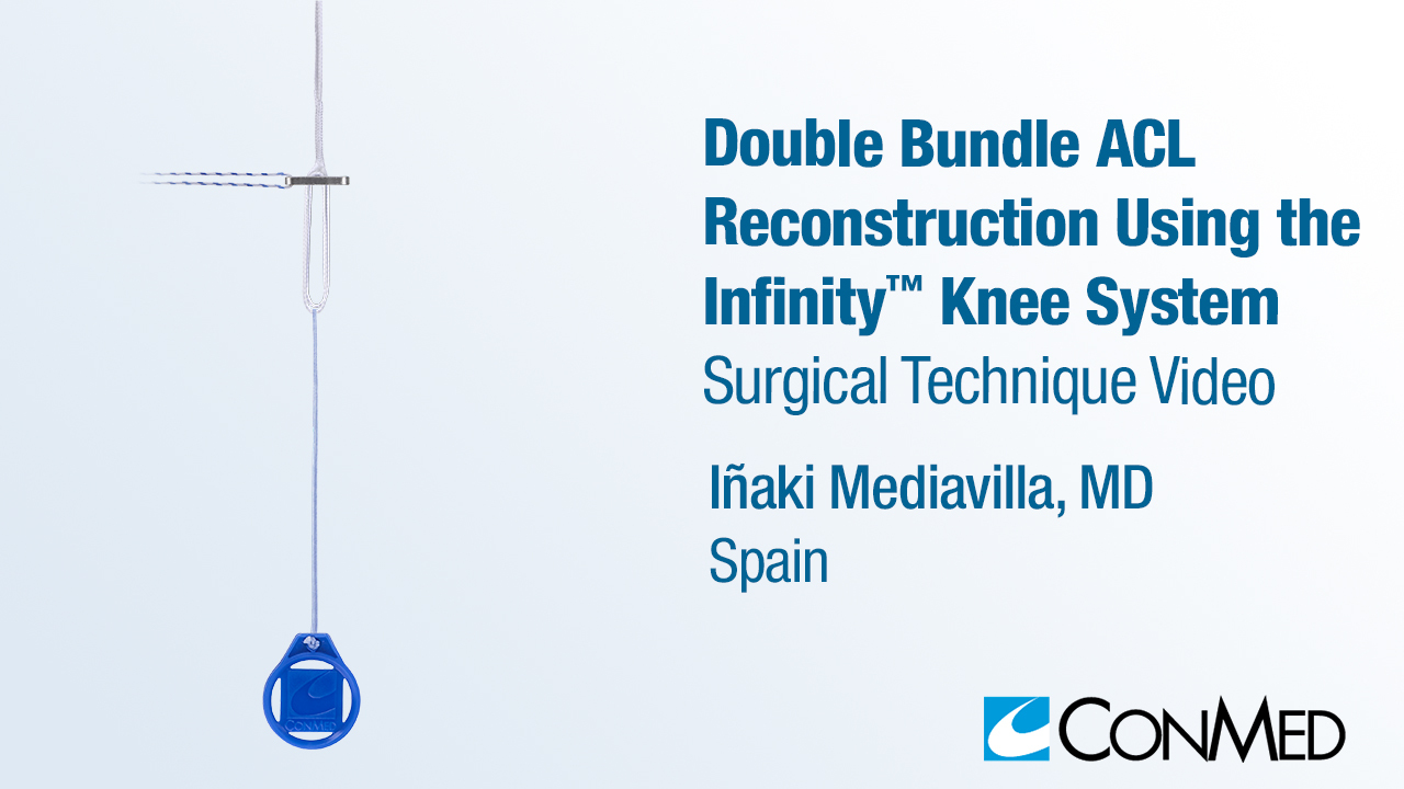 Dr. Mediavilla - Double Bundle ACL Reconstruction Using the Infinity™ Knee System