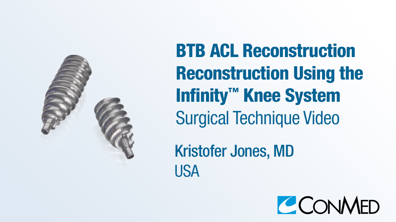 Dr. Jones - BTB ACL Reconstruction Using the Infinity™ Knee System