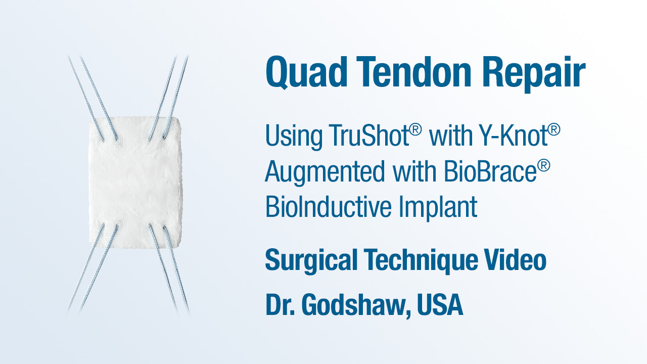 Dr. Godshaw - Quad Tendon Repair using TruShot® with Y-Knot® Augmented with BioBrace® BioInductive Implant