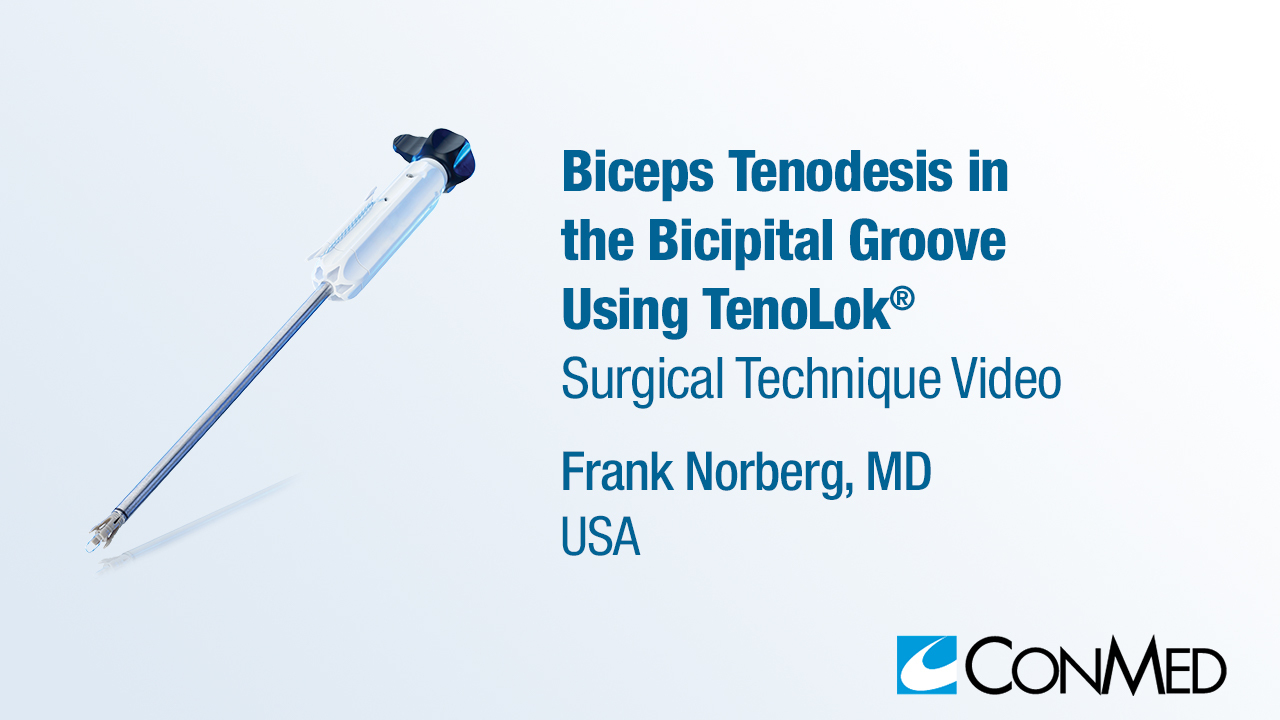 Dr. Norberg - Biceps Tenodesis in the Bicipital Groove Using TenoLok®