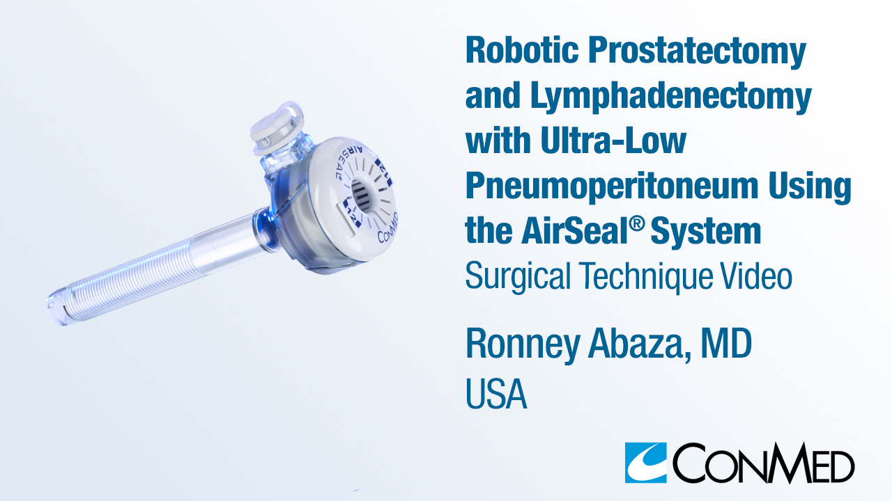 Dr. Abaza - Robotic Prostatectomy and Lymphadenectomy with Ultra-low Pneumoperitoneum Using AirSeal®