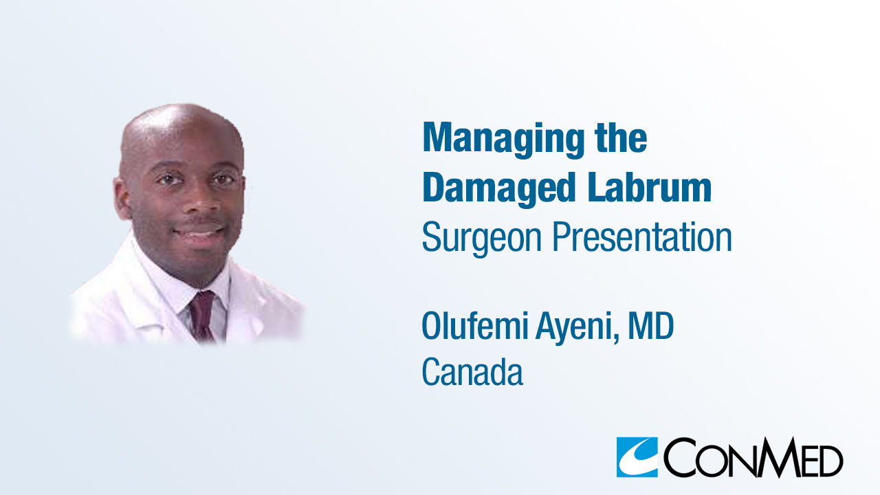 Dr. Ayeni Presentation (2019) - Managing the Damaged Labrum