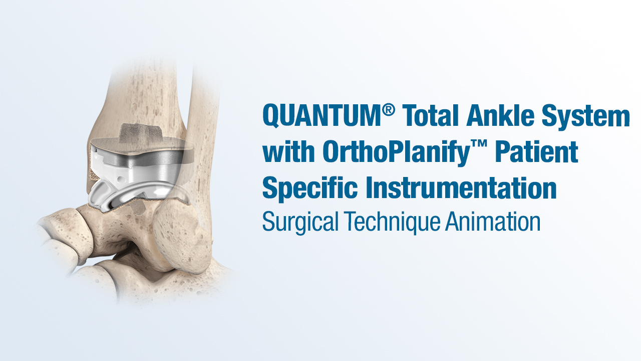 QUANTUM® Total Ankle System with OrthoPlanify™ Patient Specific Instrumentation