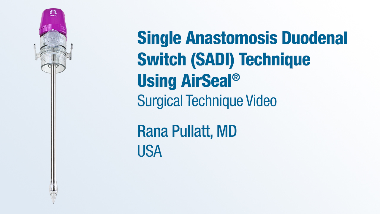 Dr. Pullatt - Single Anastomosis Duodenal Switch (SADI) Technique Using AirSeal®