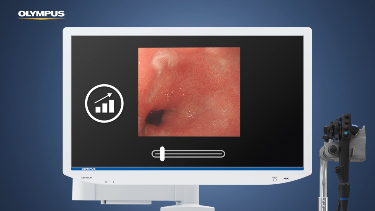 TXI technology - The New White Light - - Olympus Professional