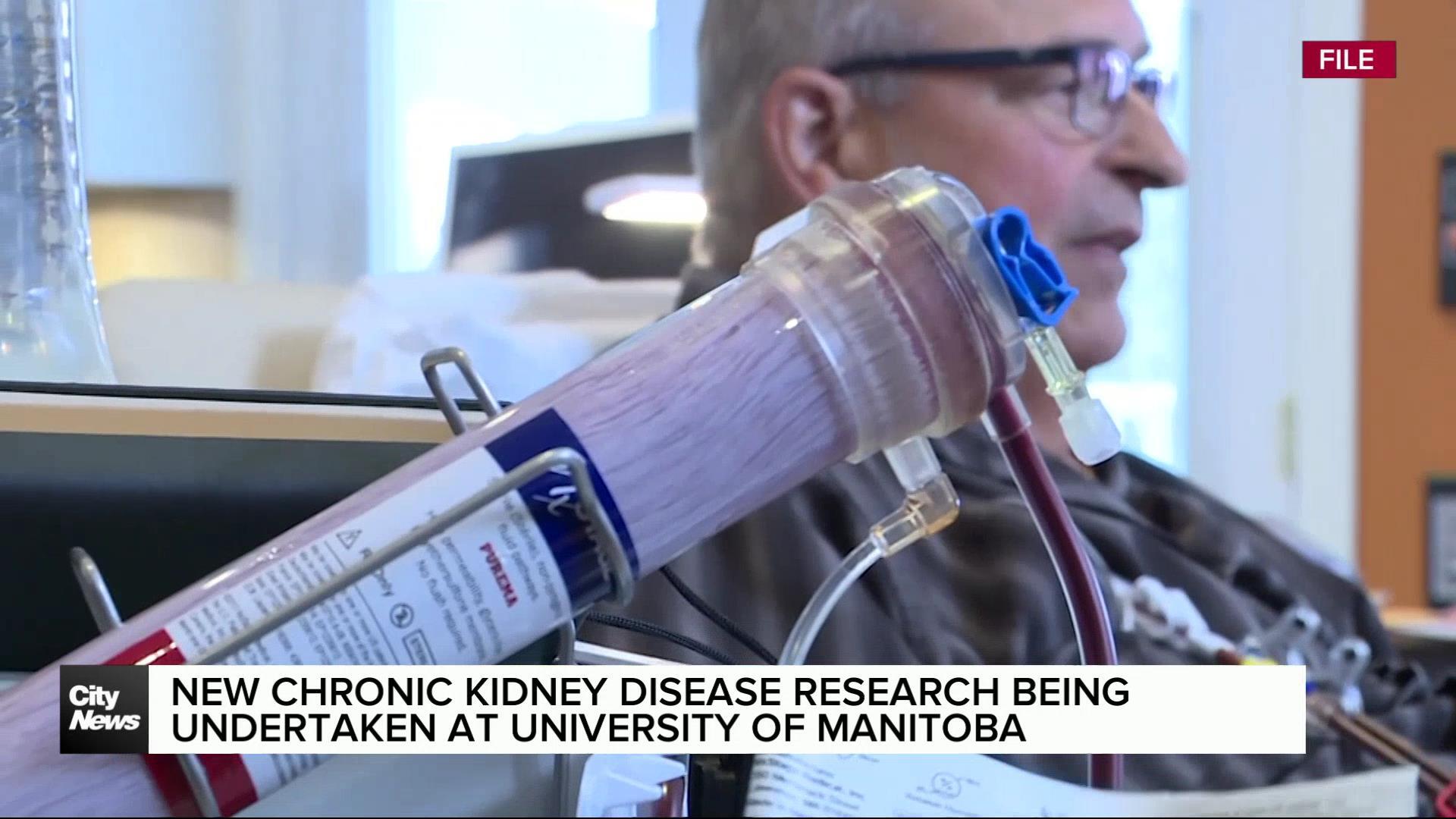 New chronic kidney disease research taking place at U of M