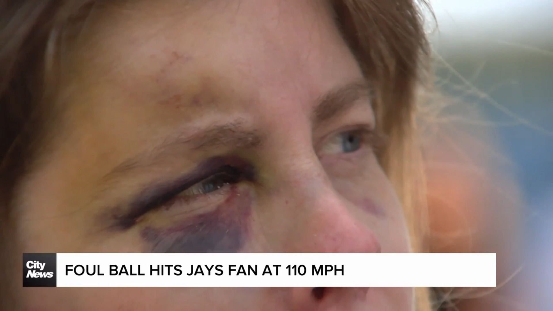 Jays fan hit by foul ball scores signed baseball and trading cards