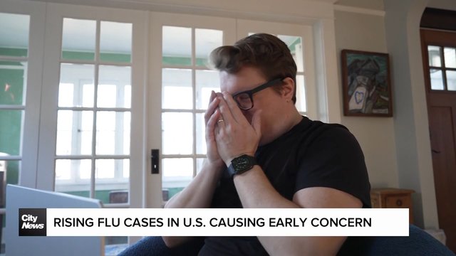 Rising flu cases in U.S. causing early concern
